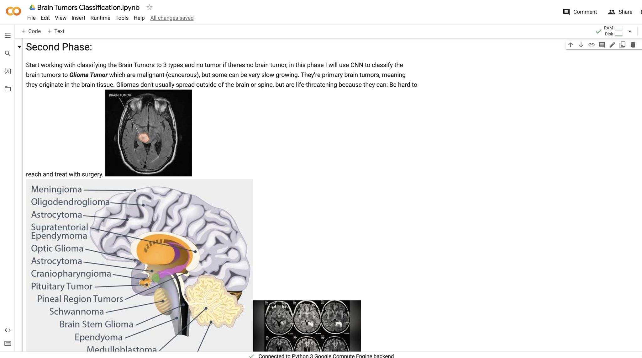 Brain Tumors Detection